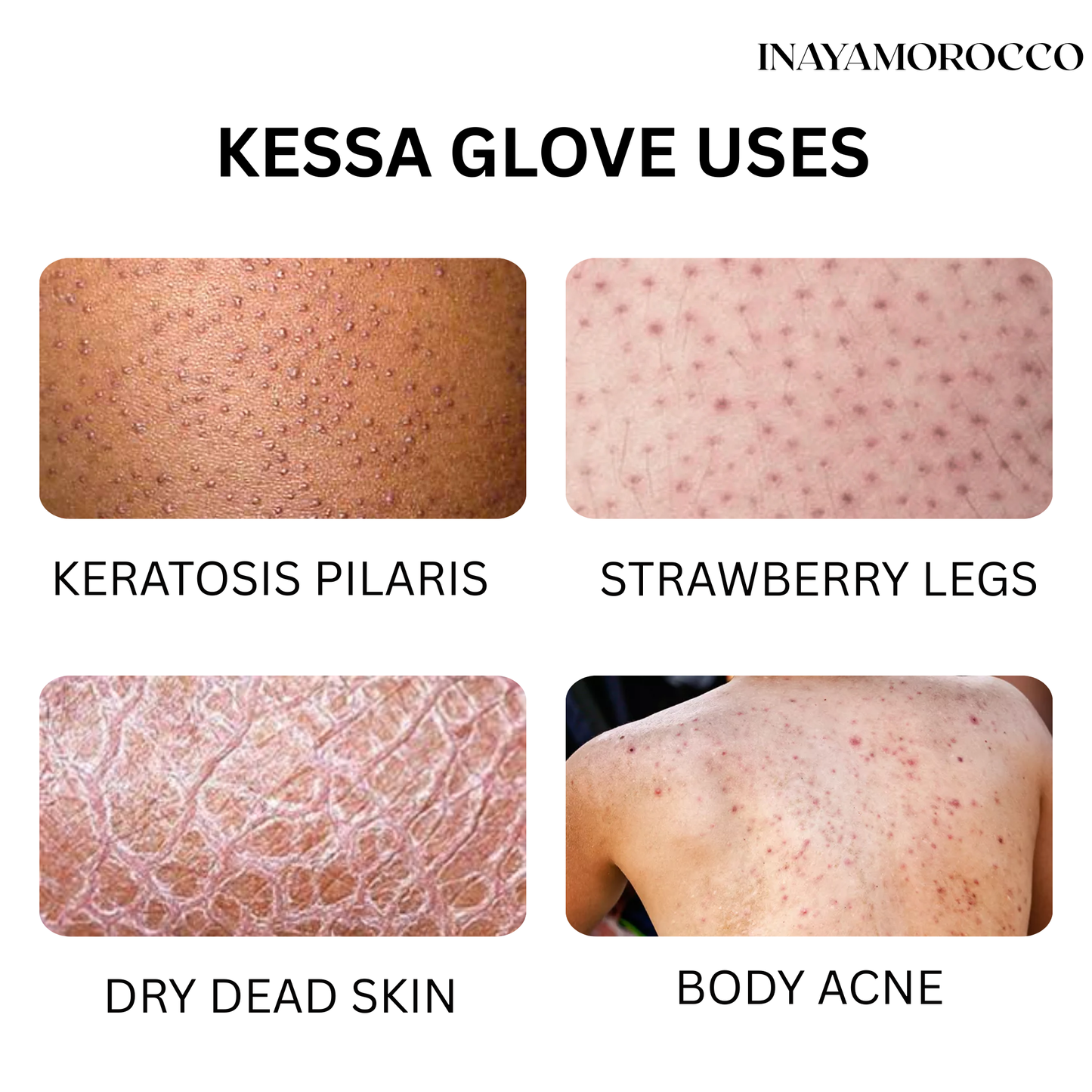 Kessa Glove | Exfoliator